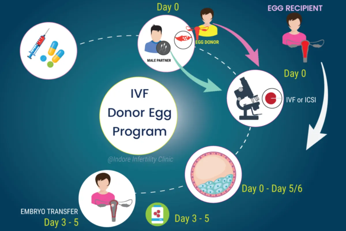 IVF WITH DONOR X