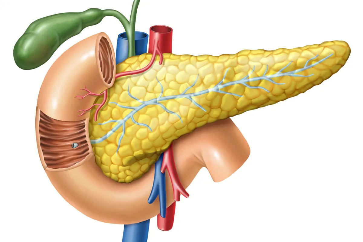 PANCREASE TRANSPLANT