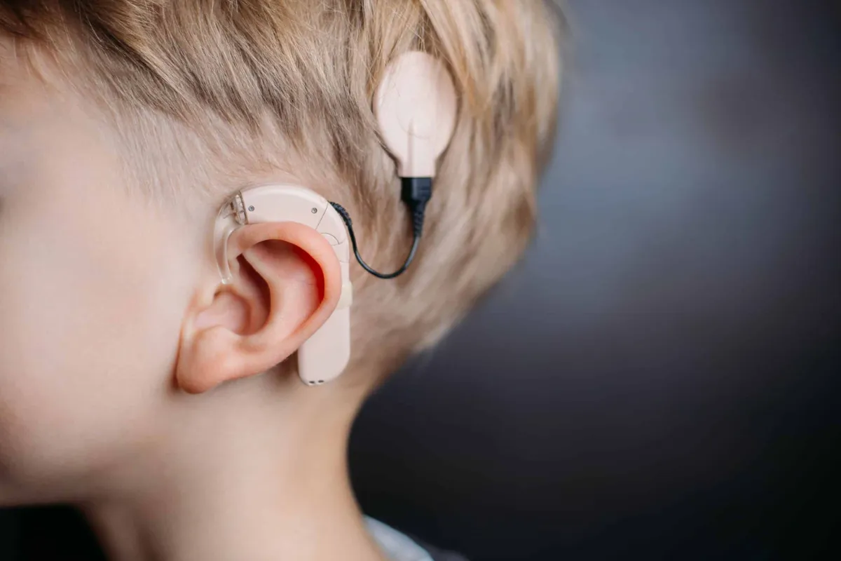 COCHLEAR IMPLANT